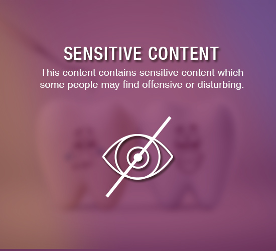 sensitive-1